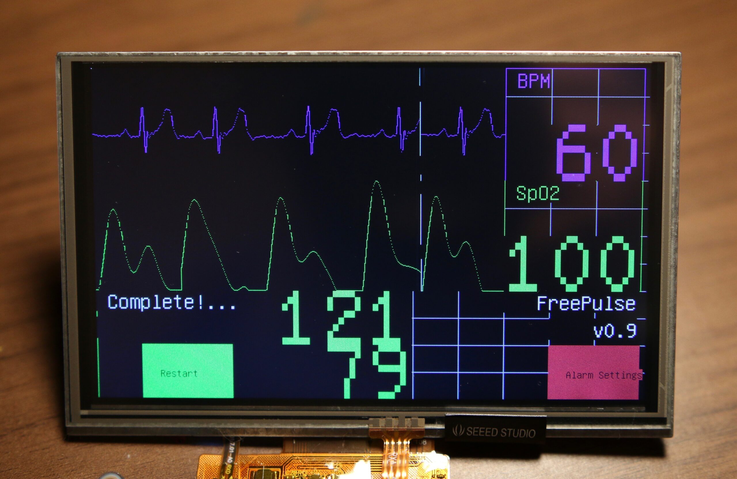 Prototype of FreePulse monitor, small screen that displays heart rate and vitals